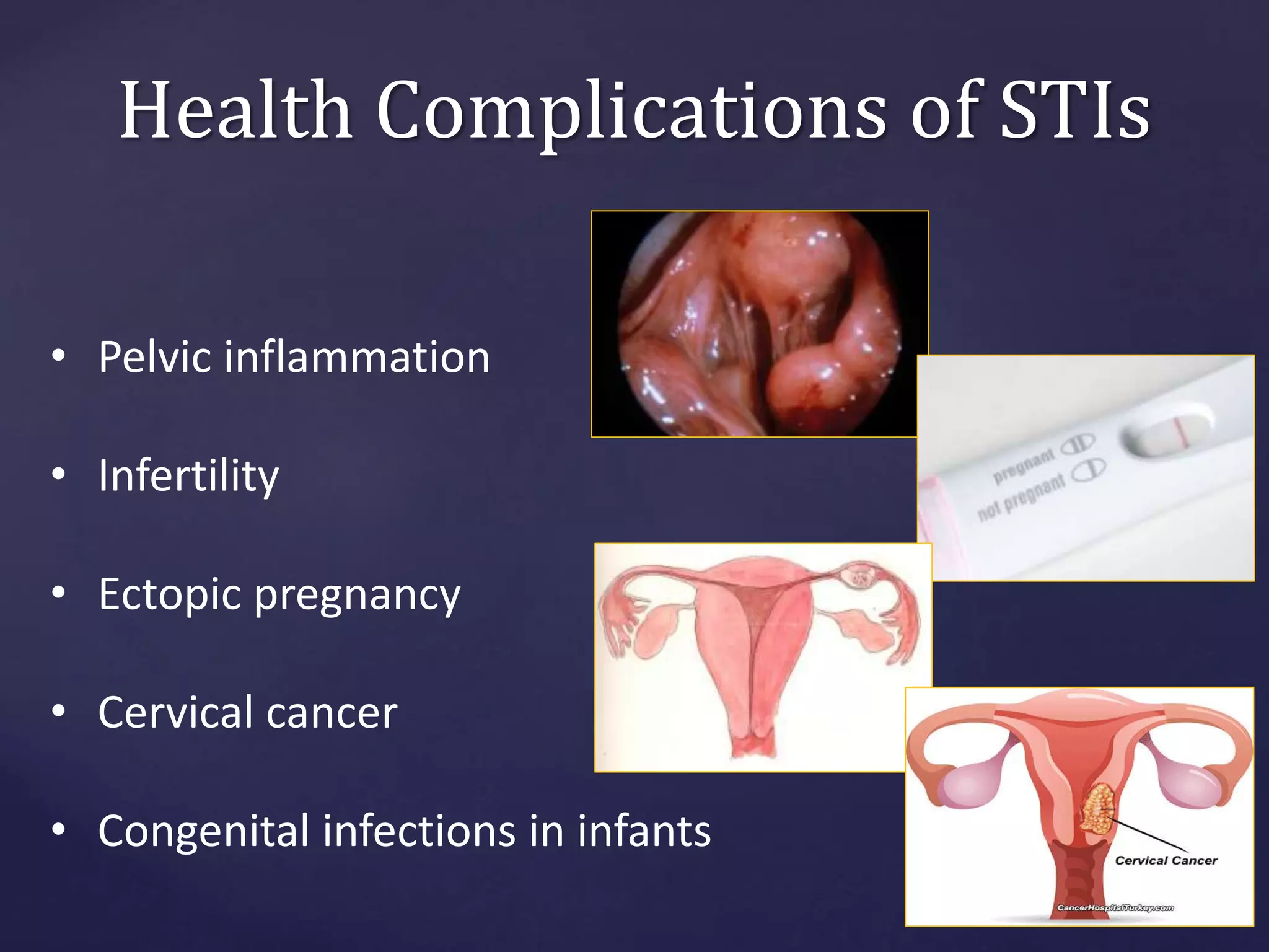 Health Complications of STIs
• Pelvic inflammation
• Infertility
• Ectopic pregnancy
• Cervical cancer
• Congenital infections in infants
 