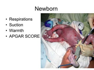 Newborn  Respirations Suction Warmth APGAR SCORE 