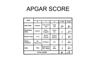 APGAR SCORE 