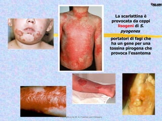 La scarlattina è provocata da ceppi  lisogeni  di  S. pyogenes   portatori di fagi che ha un gene per una tossina pirogena che provoca l’esantema 