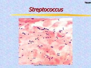 Streptococcus 