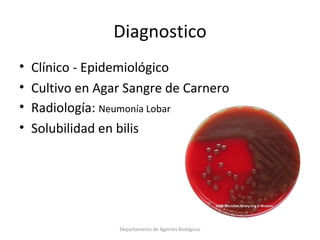 4.  Streptococcus pneumoniae