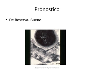 4.  Streptococcus pneumoniae