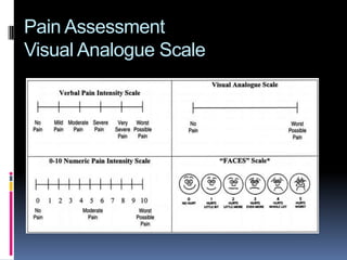 Pain Assessment
Visual Analogue Scale

 