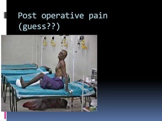 Post operative pain
(guess??)

 