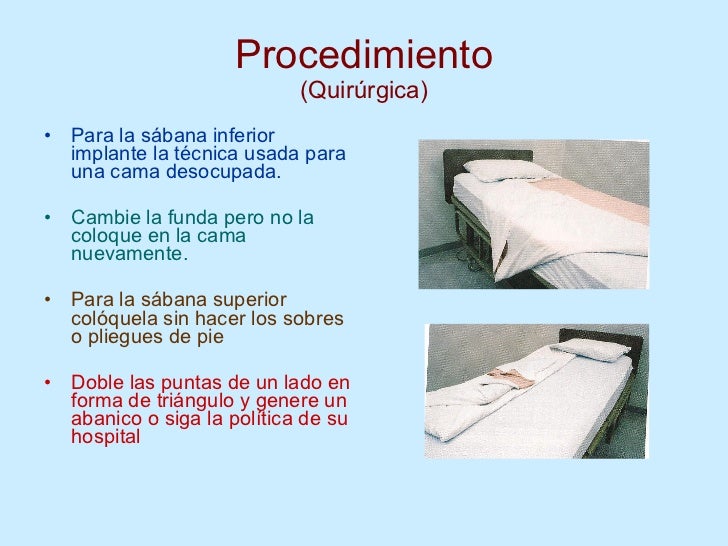 TENDIDOS DE CAMA (TÉCNICA)