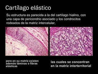 Cartílago elástico pero en su matriz existen además láminas o fibras elásticas las cuales se concentran en la matriz interterritorial Su estructura es parecida a la del cartílago hialino, con una capa de pericondrio asociado y los condrocitos rodeados de la matriz intercelular,  