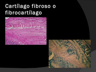 Cartílago fibroso o fibrocartílago 