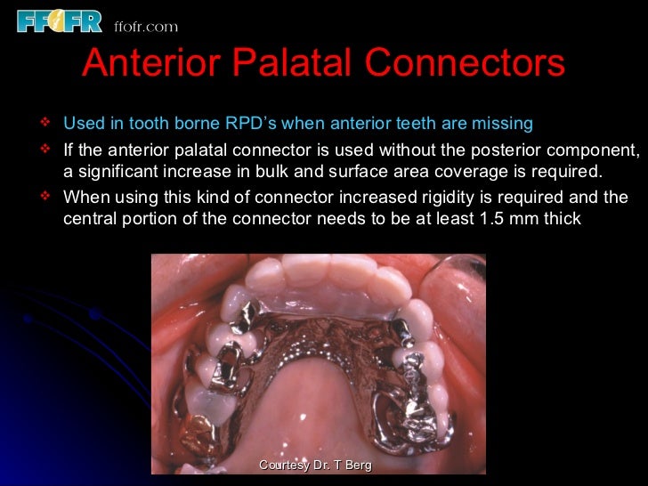 4.the tooth tissue junction, major and minor connectors