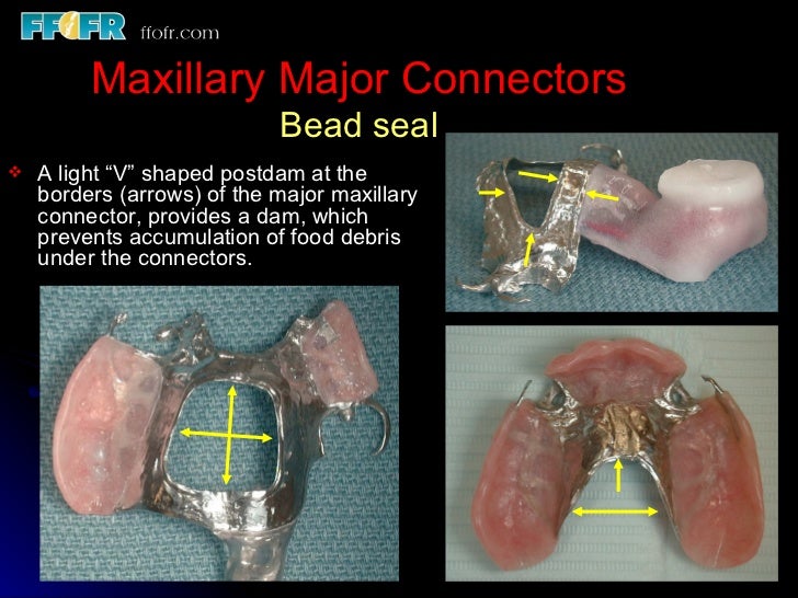 4.the tooth tissue junction, major and minor connectors