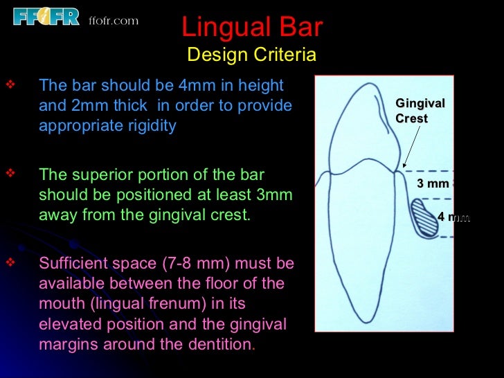 4.the tooth tissue junction, major and minor connectors
