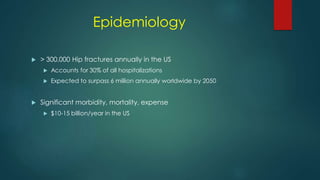 Epidemiology
 > 300,000 Hip fractures annually in the US
 Accounts for 30% of all hospitalizations
 Expected to surpass 6 million annually worldwide by 2050
 Significant morbidity, mortality, expense
 $10-15 billion/year in the US
 