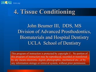 4. Tissue Conditioning John Beumer III,  DDS, MS Division of Advanced Prosthodontics, Biomaterials and Hospital Dentistry UCLA  School of Dentistry This program of instruction is protected by copyright ©.  No portion of this program of instruction may be reproduced, recorded or transferred by any means electronic, digital, photographic, mechanical etc., or by any information storage or retrieval system, without prior permission. 