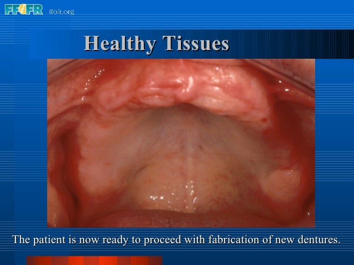 4.tissue conditioning