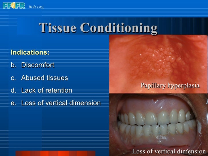 4.tissue conditioning 4.tissue conditioning