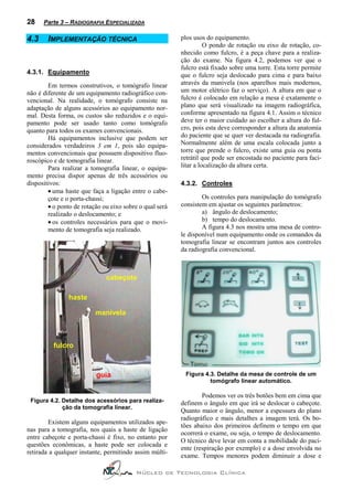 28    Parte 3 – RADIOGRAFIA ESPECIALIZADA

4.3     IMPLEMENTAÇÃO TÉCNICA                            plos usos do equipamento.
                                                                   O pondo de rotação ou eixo de rotação, co-
                                                         nhecido como fulcro, é a peça chave para a realiza-
                                                         ção do exame. Na figura 4.2, podemos ver que o
                                                         fulcro está fixado sobre uma torre. Esta torre permite
4.3.1. Equipamento                                       que o fulcro seja deslocado para cima e para baixo
        Em termos construtivos, o tomógrafo linear       através da manivela (nos aparelhos mais modernos,
não é diferente de um equipamento radiográfico con-      um motor elétrico faz o serviço). A altura em que o
vencional. Na realidade, o tomógrafo consiste na         fulcro é colocado em relação a mesa é exatamente o
adaptação de alguns acessórios ao equipamento nor-       plano que será visualizado na imagem radiográfica,
mal. Desta forma, os custos são reduzidos e o equi-      conforme apresentado na figura 4.1. Assim o técnico
pamento pode ser usado tanto como tomógrafo              deve ter o maior cuidado ao escolher a altura do ful-
quanto para todos os exames convencionais.               cro, pois esta deve corresponder a altura da anatomia
        Há equipamentos inclusive que podem ser          do paciente que se quer ver destacada na radiografia.
considerados verdadeiros 3 em 1, pois são equipa-        Normalmente além de uma escala colocada junto a
mentos convencionais que possuem dispositivo fluo-       torre que prende o fulcro, existe uma guia ou ponta
roscópico e de tomografia linear.                        retrátil que pode ser encostada no paciente para faci-
        Para realizar a tomografia linear, o equipa-     litar a localização da altura certa.
mento precisa dispor apenas de três acessórios ou
dispositivos:                                            4.3.2. Controles
        • uma haste que faça a ligação entre o cabe-
        çote e o porta-chassi;                                   Os controles para manipulação do tomógrafo
        • o ponto de rotação ou eixo sobre o qual será   consistem em ajustar os seguintes parâmetros:
        realizado o deslocamento; e                              a) ângulo de deslocamento;
        • os controles necessários para que o movi-              b) tempo do deslocamento.
        mento de tomografia seja realizado.                      A figura 4.3 nos mostra uma mesa de contro-
                                                         le disponível num equipamento onde os comandos da
                                                         tomografia linear se encontram juntos aos controles
                                                         da radiografia convencional.



                              cabeçote

                haste

                          manivela



          fulcro



                          guia                            Figura 4.3. Detalhe da mesa de controle de um
                                                                   tomógrafo linear automático.

                                                                 Podemos ver os três botões bem em cima que
 Figura 4.2. Detalhe dos acessórios para realiza-        definem o ângulo em que irá se deslocar o cabeçote.
             ção da tomografia linear.
                                                         Quanto maior o ângulo, menor a espessura do plano
                                                         radiográfico e mais detalhes a imagem terá. Os bo-
        Existem alguns equipamentos utilizados ape-
                                                         tões abaixo dos primeiros definem o tempo em que
nas para a tomografia, nos quais a haste de ligação
                                                         ocorrerá o exame, ou seja, o tempo de deslocamento.
entre cabeçote e porta-chassi é fixo, no entanto por
                                                         O técnico deve levar em conta a mobilidade do paci-
questões econômicas, a haste pode ser colocada e
                                                         ente (respiração por exemplo) e a dose envolvida no
retirada a qualquer instante, permitindo assim múlti-
                                                         exame. Tempos menores podem diminuir a dose e

                                         Núcleo de Tecnologia Clínica
 