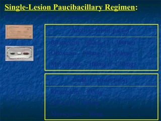 Single-Lesion Paucibacillary Regimen:
(ROM for SLPB leprosy patients)

                        Adult (2 blister packs)
                Rifampicin – 600mg (2 x 300mg)
                Ofloxacin – 400mg (2 x 200mg)
                Minocycline – 100mg (2 x 50mg)

                        Child (1 blister pack)
                Rifampicin – 300mg
                Ofloxacin – 200mg
                Minocycline – 50mg
 