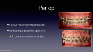 Treatment planning of surgical orthodontic cases dgkfo | PDF