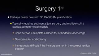 Treatment planning of surgical orthodontic cases dgkfo | PDF