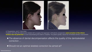 Treatment planning of surgical orthodontic cases dgkfo | PDF