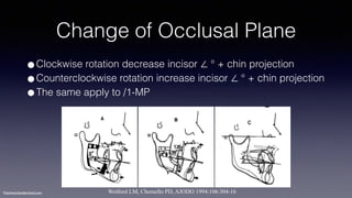 Treatment planning of surgical orthodontic cases dgkfo | PDF