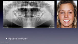 Treatment planning of surgical orthodontic cases dgkfo | PDF