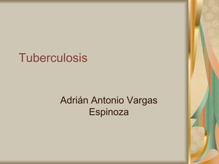 Tuberculosis Adrián Antonio Vargas Espinoza 