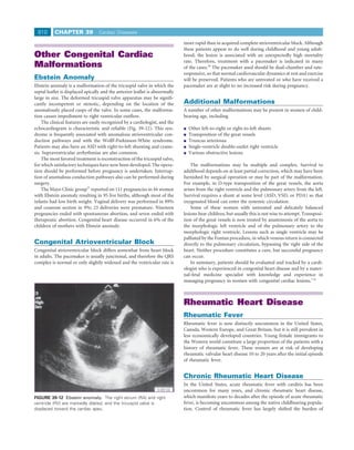 810      CHAPTER 39              Cardiac Diseases

                                                                             more rapid than in acquired complete atrioventricular block. Although
                                                                             these patients appear to do well during childhood and young adult-
Other Congenital Cardiac                                                     hood, the lesion is associated with an unexpectedly high mortality
                                                                             rate. Therefore, treatment with a pacemaker is indicated in many
Malformations                                                                of the cases.58 The pacemaker used should be dual-chamber and rate-
                                                                             responsive, so that normal cardiovascular dynamics at rest and exercise
Ebstein Anomaly                                                              will be preserved. Patients who are untreated or who have received a
Ebstein anomaly is a malformation of the tricuspid valve in which the        pacemaker are at slight to no increased risk during pregnancy.
septal leaﬂet is displaced apically and the anterior leaﬂet is abnormally
large in size. The deformed tricuspid valve apparatus may be signiﬁ-
cantly incompetent or stenotic, depending on the location of the             Additional Malformations
anomalously placed cusps of the valve. In some cases, the malforma-          A number of other malformations may be present in women of child-
tion causes impediment to right ventricular outﬂow.                          bearing age, including
    The clinical features are easily recognized by a cardiologist, and the
echocardiogram is characteristic and reliable (Fig. 39-12). This syn-          Other left-to-right or right-to-left shunts
drome is frequently associated with anomalous atrioventricular con-            Transposition of the great vessels
duction pathways and with the Wolff-Parkinson-White syndrome.                  Truncus arteriosus
Patients may also have an ASD with right-to-left shunting and cyano-           Single-ventricle double-outlet right ventricle
sis. Supraventricular arrhythmias are also common.                             Various obstructive lesions
    The most favored treatment is reconstruction of the tricuspid valve,
for which satisfactory techniques have now been developed. The opera-            The malformations may be multiple and complex. Survival to
tion should be performed before pregnancy is undertaken. Interrup-           adulthood depends on at least partial correction, which may have been
tion of anomalous conduction pathways also can be performed during           furnished by surgical operation or may be part of the malformation.
surgery.                                                                     For example, in D-type transposition of the great vessels, the aorta
    The Mayo Clinic group57 reported on 111 pregnancies in 44 women          arises from the right ventricle and the pulmonary artery from the left.
with Ebstein anomaly resulting in 95 live births, although most of the       Survival requires a shunt at some level (ASD, VSD, or PDA) so that
infants had low birth weight. Vaginal delivery was performed in 89%          oxygenated blood can enter the systemic circulation.
and cesarean section in 9%; 23 deliveries were premature. Nineteen               Some of these women with untreated and delicately balanced
pregnancies ended with spontaneous abortion, and seven ended with            lesions bear children, but usually this is not wise to attempt. Transposi-
therapeutic abortion. Congenital heart disease occurred in 6% of the         tion of the great vessels is now treated by anastomosis of the aorta to
children of mothers with Ebstein anomaly.                                    the morphologic left ventricle and of the pulmonary artery to the
                                                                             morphologic right ventricle. Lesions such as single ventricle may be
                                                                             palliated by the Fontan procedure, in which venous return is connected
Congenital Atrioventricular Block                                            directly to the pulmonary circulation, bypassing the right side of the
Congenital atrioventricular block differs somewhat from heart block          heart. Neither procedure constitutes a cure, but successful pregnancy
in adults. The pacemaker is usually junctional, and therefore the QRS        can occur.
complex is normal or only slightly widened and the ventricular rate is           In summary, patients should be evaluated and tracked by a cardi-
                                                                             ologist who is experienced in congenital heart disease and by a mater-
                                                                             nal-fetal medicine specialist with knowledge and experience in
                                                                             managing pregnancy in women with congenital cardiac lesions.7,31




                                        RV
                                                                             Rheumatic Heart Disease
                                                                             Rheumatic Fever
                                                                             Rheumatic fever is now distinctly uncommon in the United States,
                                                                             Canada, Western Europe, and Great Britain, but it is still prevalent in
                                                                             less economically developed countries. Young female immigrants to
                                                                             the Western world constitute a large proportion of the patients with a
                                RA                                           history of rheumatic fever. These women are at risk of developing
                                                                             rheumatic valvular heart disease 10 to 20 years after the initial episode
                                                                             of rheumatic fever.


                                                                             Chronic Rheumatic Heart Disease
                                                                             In the United States, acute rheumatic fever with carditis has been
                                                                             uncommon for many years, and chronic rheumatic heart disease,
FIGURE 39-12 Ebstein anomaly. The right atrium (RA) and right                which manifests years to decades after the episode of acute rheumatic
ventricle (RV) are markedly dilated, and the tricuspid valve is              fever, is becoming uncommon among the native childbearing popula-
displaced toward the cardiac apex.                                           tion. Control of rheumatic fever has largely shifted the burden of
 