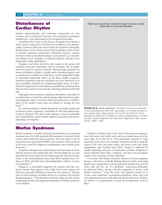 818       CHAPTER 39             Cardiac Diseases



Disturbances of
Cardiac Rhythm
Isolated supraventricular and ventricular extrasystoles are very
common, and no treatment is necessary. Pre-conception counseling is
simpliﬁed by a clear appreciation of several general principles.
    Arrhythmia that occurs in the absence of organic heart disease is
almost always benign and is therefore not an indication for pharma-
cologic treatment unless the woman ﬁnds the symptoms intolerable.
Reassuring her of the benign nature of this symptom is often all that
is required. Sustained symptomatic arrhythmia, however, requires
treatment, which can be pharmacologic or procedural (e.g., transcath-
eter ablation of an anomalous conduction pathway, insertion of an
implantable cardiac deﬁbrillator).
    Pregnancy and labor should be safe except in the group with
sustained ventricular arrhythmia, with its attendant risk of cardiac
arrest and need for vigorous treatment. Pharmacologic treatment for
serious arrhythmia is likely to include newly introduced agents, such
as amiodarone or sotalol, for which there is at best limited knowledge
of potentially unfavorable effects on the fetus. Ideally, pregnancy
should be postponed until the arrhythmia has been eliminated or at
least controlled, preferably by nonpharmacologic means. If antiar-
rhythmic drugs must be used, whenever possible they should be those
that have been used for several decades, allowing prediction of the fetal
risk.
    High-grade atrioventricular conduction disturbance, especially if it
is symptomatic, is treated by artiﬁcial pacing, which should not inﬂu-
ence pregnancy, labor, or the fetus. Electrical cardioversion or deﬁbril-
lation of the mother’s heart does not disturb or damage the fetal
heart.118
    It is clearly desirable to evaluate disturbances of cardiac rhythm and    FIGURE 39-18 Aortic aneurysm. Aortogram showing an aneurysm
conduction before pregnancy, proceeding to full electrophysiologic            of the ascending aorta (AO) with regurgitation of contrast through an
testing if indicated. This plan avoids exposing a fetus to potentially        incompetent aortic valve (arrows) into the left ventricle (LV). (From
                                                                              Shabetai R, Adolph RJ: Principles of cardiac catheterization. In Fowler
toxic antiarrhythmic agents and the radiation associated with electro-
                                                                              NO [ed]: Cardiac Diagnosis and Treatment. Hagerstown, MD: Harper
physiologic investigation.
                                                                              & Row, 1980, p 106.)


Marfan Syndrome
Marfan syndrome is variably expressed and inherited as an autosomal              Deﬁciency of elastic tissue is the cause of myxomatous degenera-
dominant trait. If it is left untreated, life expectancy is reduced by half   tion of the aortic and mitral valves and cystic medial necrosis of the
in those who exhibit the classic syndrome. The basic defect is one of         aorta (Figs. 39-18 and 39-19). This abnormality translates to large
connective tissue, particularly ﬁbrillin, and connective tissue weakness      aneurysms of the aortic root, multiple aneurysms elsewhere along the
in the aorta causes the dangerous complications, most notably aortic          course of the aorta and great vessels, and severe aortic and mitral
dissection.119                                                                regurgitation with resulting heart failure. Surgery is indicated for
    Symptoms and signs may include dyspnea and chest pain, an aortic          rapidly expanding aneurysm or if dissection is evident. Pregnancy is
diastolic murmur, and a midsystolic click. The best diagnostic test, and      poorly tolerated under these conditions, and labor may precipitate
apparently the most critical one for determining the outcome of preg-         rupture of an aneurysm or aortic dissection.
nancy, is the echocardiogram. More than 90% of patients have evi-                If a woman with Marfan syndrome chooses to become pregnant,
dence of MVP, and 60% have echocardiographic evidence of aortic               therapy is directed at markedly limiting physical activity, preventing
root dilatation.120                                                           hypertensive complications, and decreasing the pulsatile forces on the
    Pregnancy is particularly dangerous for patients with this syn-           aortic wall with the use of a β-blocker. Long-acting β-blockers
drome, because there appears to be a high risk of aortic rupture and          are indicated before, during, and after pregnancy in women with
dissection, especially if dilatation of the aortic root is present.47 Women   Marfan syndrome.122 Once the aortic root diameter reaches 50 to
with an aortic diameter exceeding 40 mm are at greatest risk of death         55 mm, most authorities recommend prophylactic aortic valve and
during pregnancy.121 The physician should also make sure the woman            root replacement because of the high risk of aortic dissection. Abdomi-
understands the 50% risk of genetic transmission of Marfan syndrome           nal delivery is recommended to avoid the hemodynamic stress of
to her children.                                                              labor.
 