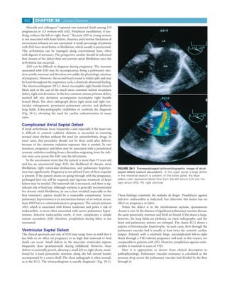 802      CHAPTER 39              Cardiac Diseases

    Metcalfe and colleagues33 reported one maternal death among 219
pregnancies in 113 women with ASD. Peripheral vasodilation, if any-
thing, reduces the left-to-right shunt.17 Because ASD in young women
is not associated with heart failure, diuretics and extreme limitation of
                                                                                                                 LA
intravenous infusion are not warranted. A small percentage of patients
with ASD have atrial ﬂutter or ﬁbrillation, which usually is paroxysmal.
This arrhythmia can be managed along conventional lines, often
with digoxin if necessary. The prospective mother should be informed
that closure of the defect does not prevent atrial ﬁbrillation once the
arrhythmia has occurred.
    ASD can be difﬁcult to diagnose during pregnancy. The murmur                                                  RA
associated with ASD may be inconspicuous, being a pulmonary ejec-
                                                                                              RV
tion systolic murmur and therefore not unlike the physiologic murmur
of pregnancy. However, the second heart sound is widely split and may
be ﬁxed throughout the respiratory cycle, a distinctly abnormal ﬁnding.
The electrocardiogram (ECG) shows incomplete right bundle branch
block and, in the case of the much more common ostium secundum
defect, right axis deviation. In the less common ostium primum defect,
marked left axis deviation accompanies incomplete right bundle
branch block. The chest radiograph shows right atrial and right ven-
tricular enlargement, prominent pulmonary arteries, and plethoric
lung ﬁelds. Echocardiography establishes or conﬁrms the diagnosis                                                LA
(Fig. 39-1), obviating the need for cardiac catheterization in many
cases.

Complicated Atrial Septal Defect
If atrial arrhythmias recur frequently—and especially if the heart rate
is difﬁcult to control—catheter ablation is successful in restoring                                                RA
normal sinus rhythm without the need for antiarrhythmic drugs. In
most cases, this procedure should not be done until after delivery                             RV
because of the extensive radiation exposure that is needed. In rare
instances, pregnancy and labor may be associated with a paradoxical
systemic embolus resulting from a thrombus migrating from the infe-
rior vena cava across the ASD into the left atrium.
    In the uncommon event that the patient is more than 35 years old
and has an uncorrected large ASD, the likelihood of chronic atrial
ﬁbrillation, right ventricular dysfunction, and pulmonary hyperten-          FIGURE 39-1 Transesophageal echocardiographic image of atrial
sion rises signiﬁcantly. Pregnancy is not advised if any of these sequelae   septal defect (ostium secundum). In the upper panel, a large defect
is present. If the patient insists on going through with the pregnancy,      in the interatrial septum is present. In the lower panel, the blue/
prolonged bed rest will be required, and vigorous treatment of heart         yellow color represents blood ﬂow from the left atrium (LA) into the
failure may be needed. The maternal risk is increased, and there is sig-     right atrium (RA). RV, right ventricle.
niﬁcant risk of fetal loss. Although warfarin is generally recommended
for chronic atrial ﬁbrillation, its use is best avoided (especially in the
ﬁrst trimester); aspirin would be a reasonable compromise. Severe            These ﬁndings constitute the maladie de Roger. Prophylaxis against
pulmonary hypertension is an uncommon feature of an ostium secun-            infective endocarditis is indicated, but otherwise this lesion has no
dum ASD but is a contraindication to pregnancy. The ostium primum            effect on pregnancy or labor.
ASD, which is associated with Down syndrome and poses a risk of                  When the defect is in the membranous septum, spontaneous
endocarditis, is more often associated with severe pulmonary hyper-          closure is rare. In the absence of signiﬁcant pulmonary vascular disease,
tension. Infective endocarditis rarely, if ever, complicates a simple        the same pansystolic murmur and thrill are found. If the shunt is large,
ostium secundum ASD; therefore, prophylaxis during labor is not              however, the lung ﬁelds are plethoric on chest radiography, and the
warranted.                                                                   heart and pulmonary arteries are enlarged. The classic ECG shows a
                                                                             pattern of biventricular hypertrophy. In such cases, ﬂow through the
Ventricular Septal Defect                                                    pulmonary vascular bed is usually at least twice the systemic cardiac
The clinical spectrum and risk of VSD may range from so mild that it         output. Patients with a relatively large, uncomplicated left-to-right
has little or no effect on pregnancy to so high that maternal or fetal       shunt through a VSD tolerate pregnancy well and, in this respect, are
death can occur. Small defects in the muscular ventricular septum            comparable to patients with ASD. However, prophylaxis against endo-
frequently close spontaneously during childhood. However, these              carditis is essential in cases of VSD.
defects occasionally persist, allowing a small left-to-right shunt, mani-        Here it is appropriate to detour from clinical description to
fested by a loud pansystolic murmur along the left sternal border            pathophysiology. Pulmonary vascular resistance is calculated as the
accompanied by a coarse thrill. The chest radiograph is often normal,        pressure drop across the pulmonary vascular bed divided by the ﬂow
as is the ECG. The echocardiogram is usually diagnostic (Fig. 39-2).         through it:
 