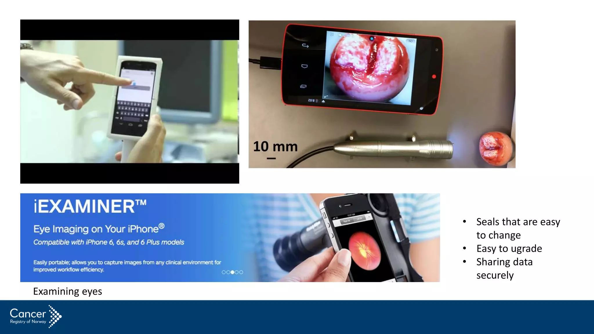 • Seals that are easy
to change
• Easy to ugrade
• Sharing data
securely
Examining eyes
 