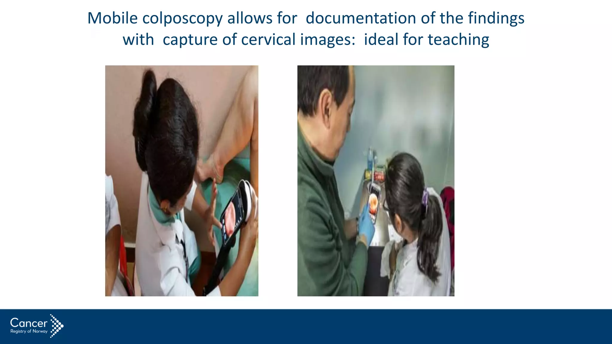 Mobile colposcopy allows for documentation of the findings
with capture of cervical images: ideal for teaching
 