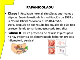PAPANICOLAOU
• Clase l Resultado normal, sin células anormales o
atípicas. Según lo estipula la modificación de 1998 a
la Norma Oficial Mexicana NOM-014-SSA21994, después de dos resultados anuales de este tipo
se recomienda tomar la muestra cada tres años.
• Clase ll Existe presencia de células atípicas pero
no hay evidencia de cáncer; puede haber un proceso
inflamatorio cervical.

 