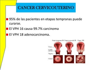 CANCER CERVICOUTERINO
95% de las pacientes en etapas tempranas puede
curarse.
El VPH 16 causa 99.7% carcinoma
El VPH 18 adenocarcinoma.

 