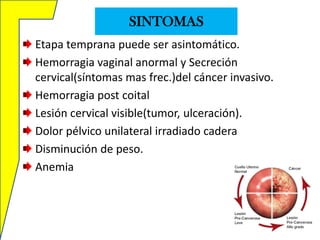 SINTOMAS
Etapa temprana puede ser asintomático.
Hemorragia vaginal anormal y Secreción
cervical(síntomas mas frec.)del cáncer invasivo.
Hemorragia post coital
Lesión cervical visible(tumor, ulceración).
Dolor pélvico unilateral irradiado cadera
Disminución de peso.
Anemia

 