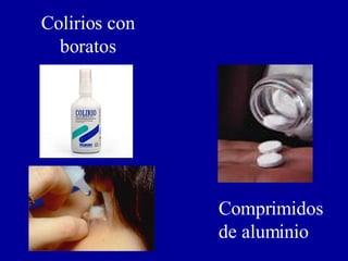 Colirios con boratos Comprimidos de aluminio 