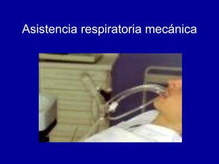 Asistencia respiratoria mecánica 