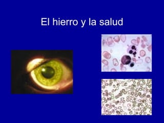 El hierro y la salud 