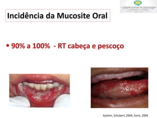 Incidência da Mucosite Oral
 90% a 100% - RT cabeça e pescoço
Epstein, Schubert, 2004; Sonis, 2004
 