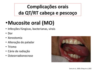 Sonis et al., 2009; Elting et al.,2007
Complicações orais
da QT/RT cabeça e pescoço
•Mucosite oral (MO)
• Infecções fúngicas, bacterianas, virais
• Dor
• Xerostomia
• Alteração do paladar
• Trismo
• Cárie de radiação
• Osteorradionecrose
 