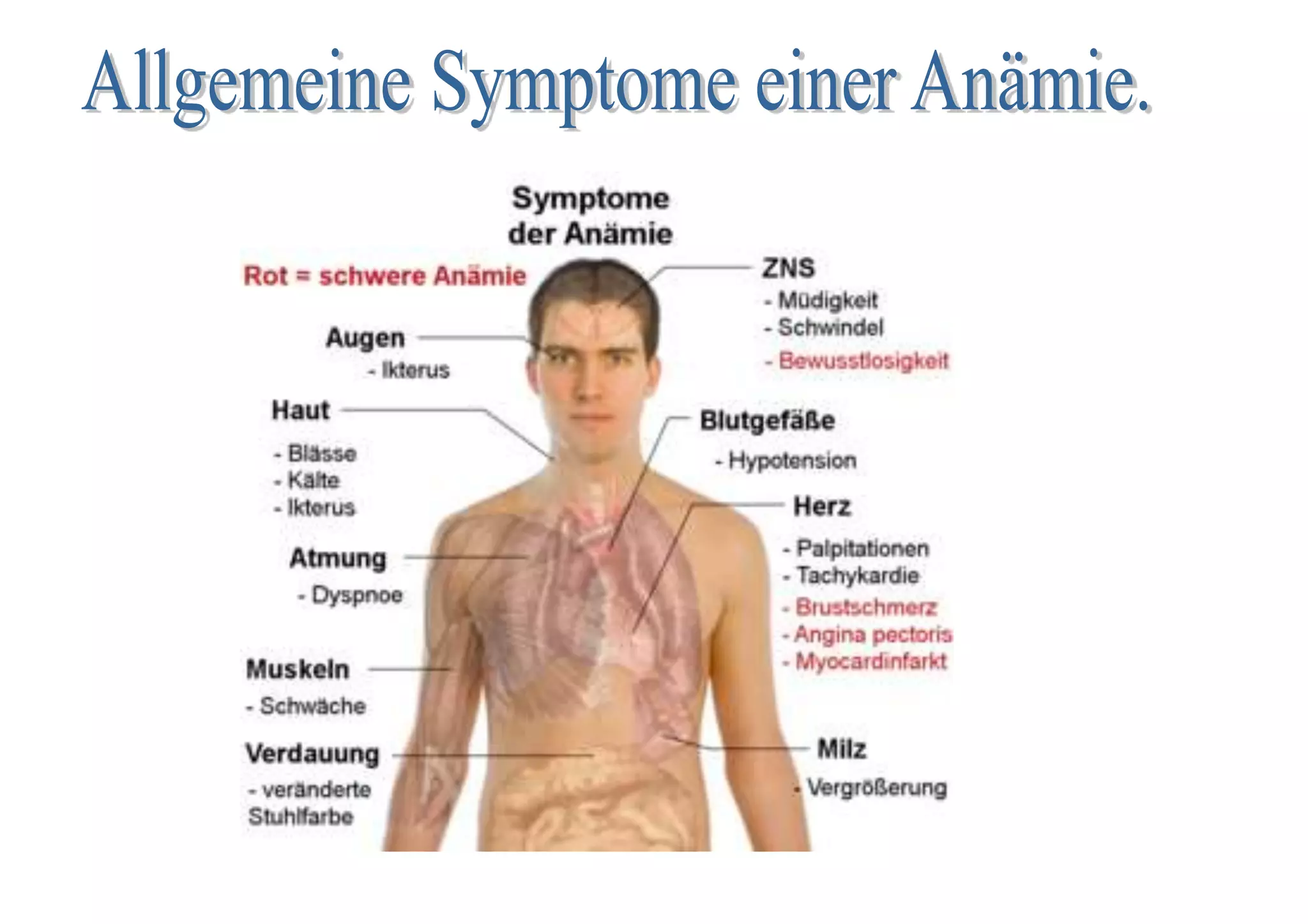Was Ist Anämie Bei Menschen de.slideshare.net