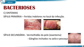 BACTERIOSES
C) SINTOMAS
SÍFILIS PRIMÁRIA – Feridas indolores no local da infecção.
SÍFILIS SECUNDÁRIA - Vermelhidão da pele (exantema)
- Gânglios inchados na axila e pescoço.
22
 