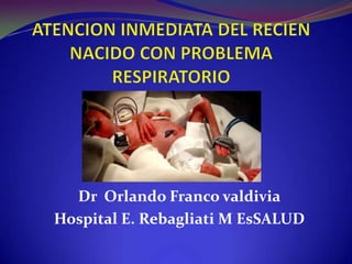Dr Orlando Franco valdivia
Hospital E. Rebagliati M EsSALUD
 