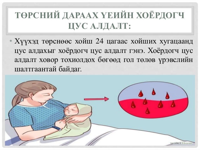 Төрсний дараах хожуу үеийн цус алдалт, авах арга хэмжээ
