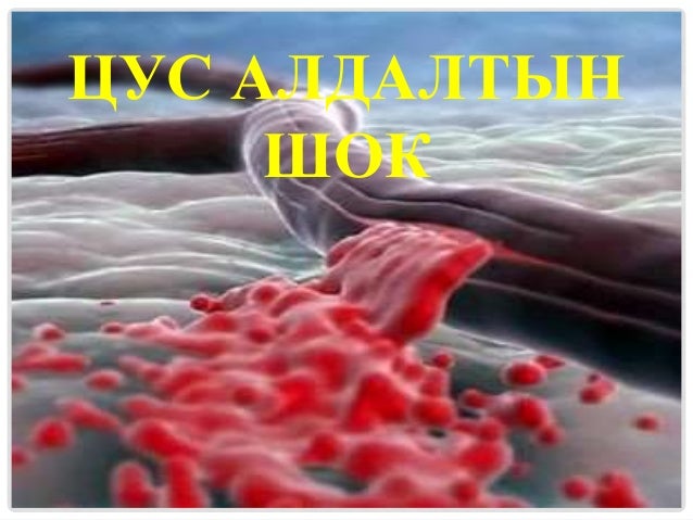 Төрсний дараах хожуу үеийн цус алдалт, авах арга хэмжээ