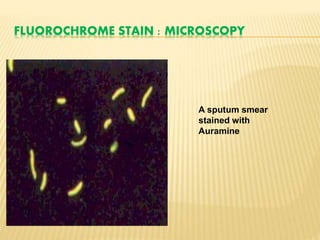 FLUOROCHROME STAIN : MICROSCOPY
A sputum smear
stained with
Auramine
 