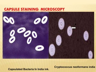 CAPSULE STAINING: MICROSCOPY
Capsulated Bacteria In India ink.
Cryptococcus neoformans india i
 