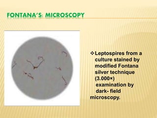 FONTANA’S: MICROSCOPY
Leptospires from a
culture stained by
modified Fontana
silver technique
(3.000×)
examination by
dark- field
microscopy.
 