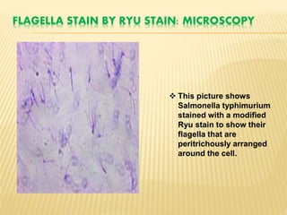 FLAGELLA STAIN BY RYU STAIN: MICROSCOPY
 This picture shows
Salmonella typhimurium
stained with a modified
Ryu stain to show their
flagella that are
peritrichously arranged
around the cell.
 