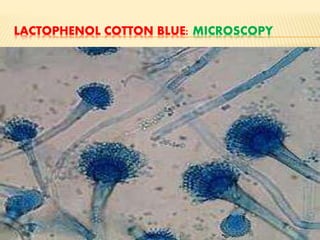 LACTOPHENOL COTTON BLUE: MICROSCOPY
 